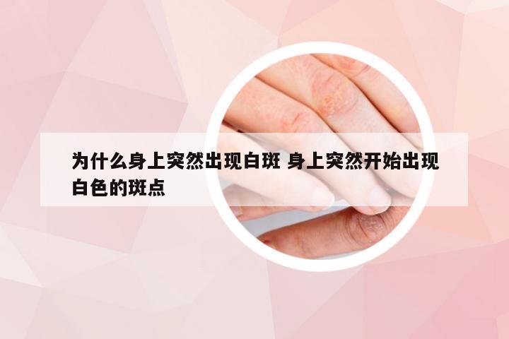 为什么身上突然出现白斑 身上突然开始出现白色的斑点