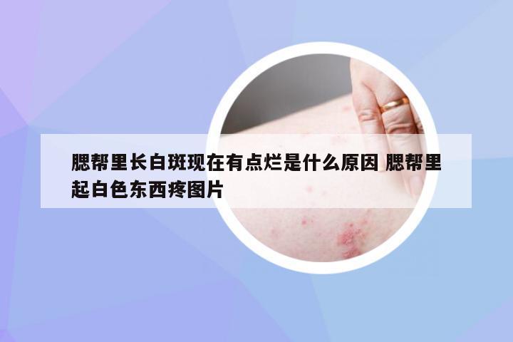 腮帮里长白斑现在有点烂是什么原因 腮帮里起白色东西疼图片