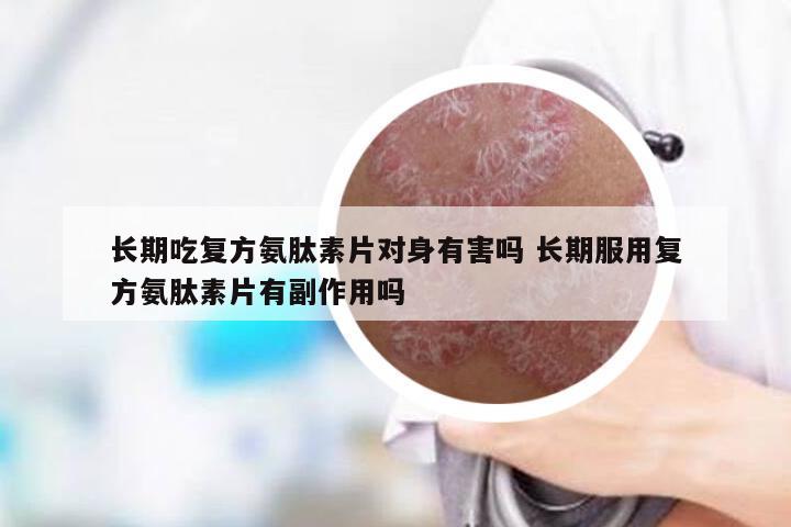 长期吃复方氨肽素片对身有害吗 长期服用复方氨肽素片有副作用吗