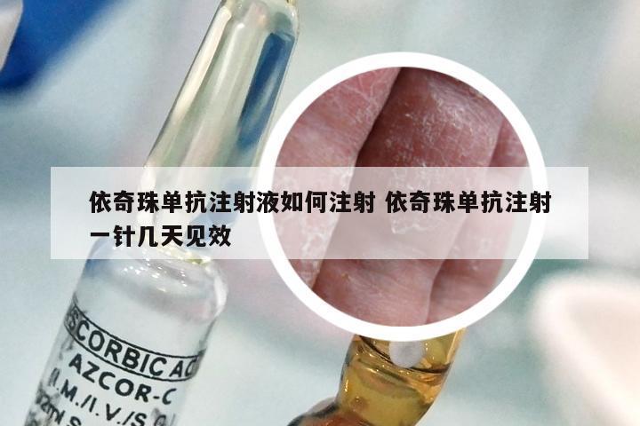 依奇珠单抗注射液如何注射 依奇珠单抗注射一针几天见效