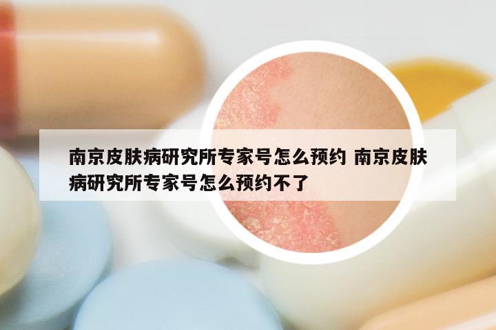 南京皮肤病研究所专家号怎么预约 南京皮肤病研究所专家号怎么预约不了