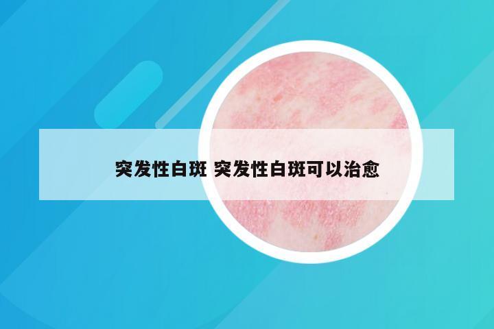 突发性白斑 突发性白斑可以治愈