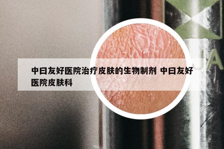 中曰友好医院治疗皮肤的生物制剂 中曰友好医院皮肤科