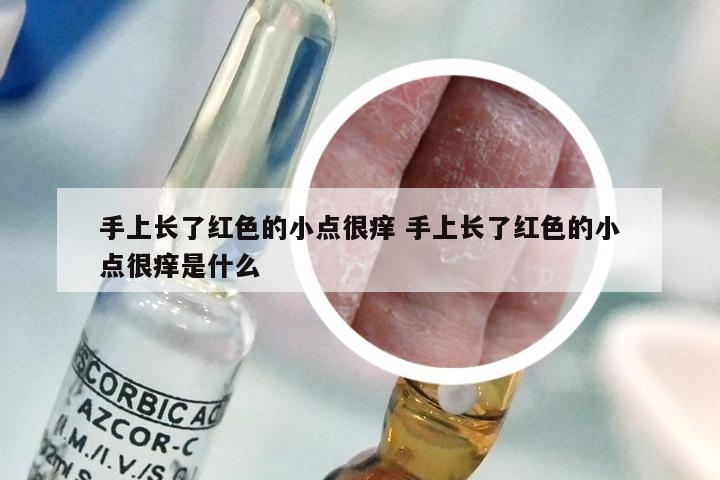 手上长了红色的小点很痒 手上长了红色的小点很痒是什么