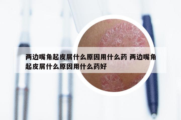 两边嘴角起皮屑什么原因用什么药 两边嘴角起皮屑什么原因用什么药好