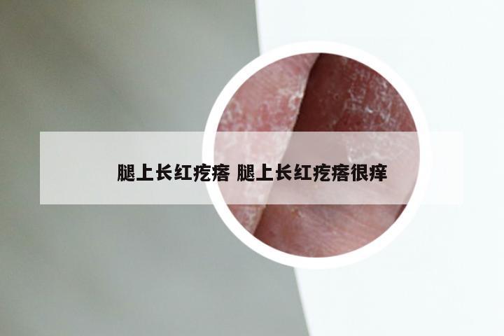 腿上长红疙瘩 腿上长红疙瘩很痒