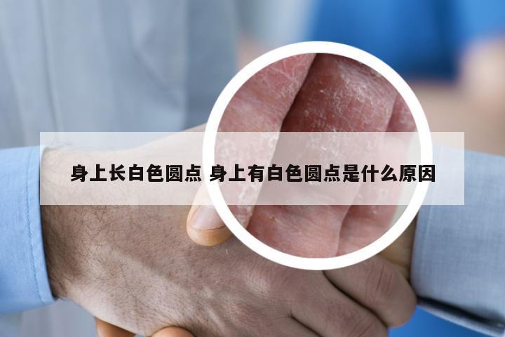 身上长白色圆点 身上有白色圆点是什么原因