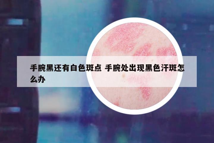 手腕黑还有白色斑点 手腕处出现黑色汗斑怎么办