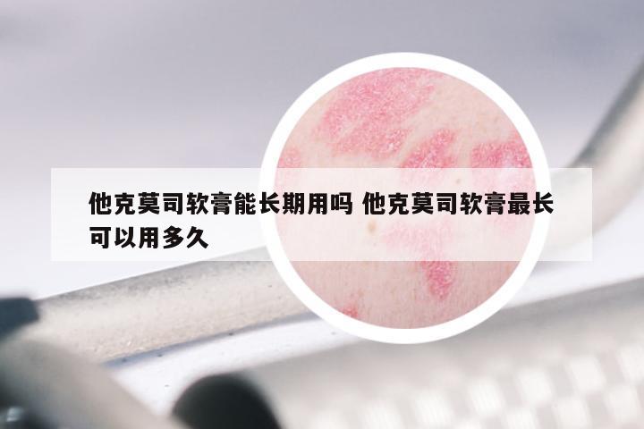 他克莫司软膏能长期用吗 他克莫司软膏最长可以用多久