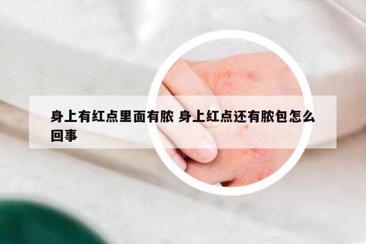 身上有红点里面有脓 身上红点还有脓包怎么回事