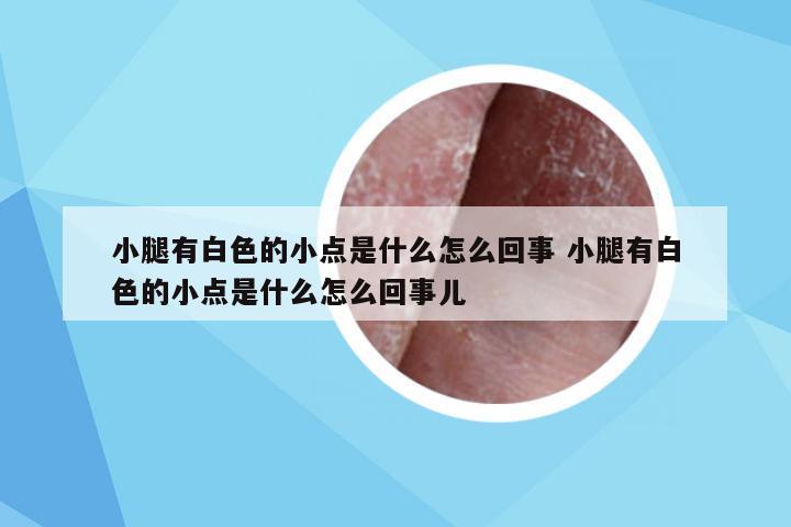 小腿有白色的小点是什么怎么回事 小腿有白色的小点是什么怎么回事儿