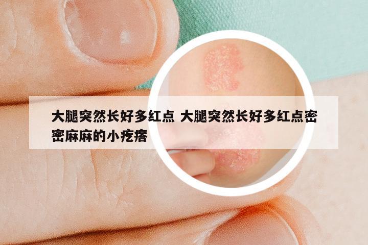 大腿突然长好多红点 大腿突然长好多红点密密麻麻的小疙瘩