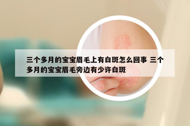 三个多月的宝宝眉毛上有白斑怎么回事 三个多月的宝宝眉毛旁边有少许白斑