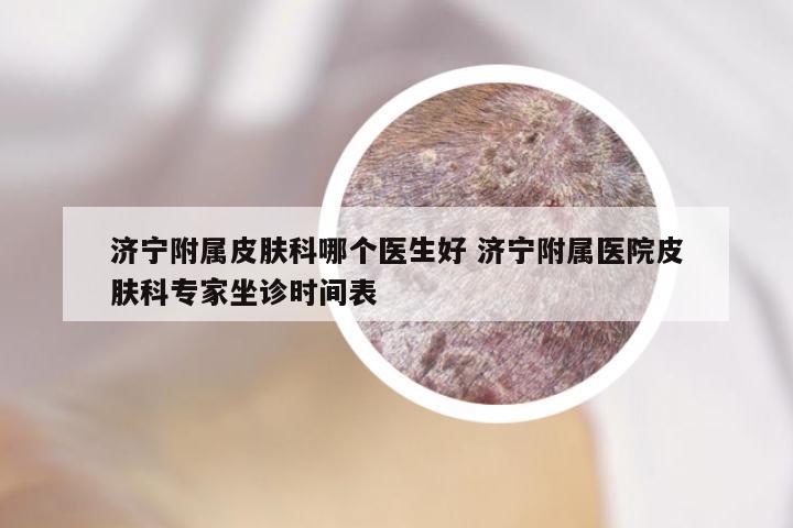 济宁附属皮肤科哪个医生好 济宁附属医院皮肤科专家坐诊时间表