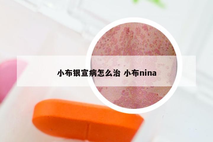 小布银宣病怎么治 小布nina