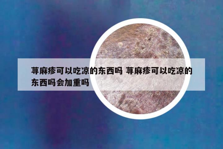 荨麻疹可以吃凉的东西吗 荨麻疹可以吃凉的东西吗会加重吗