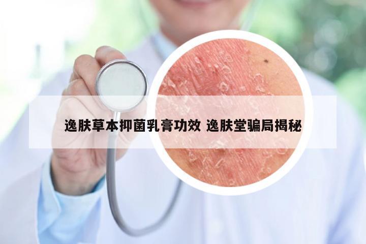 逸肤草本抑菌乳膏功效 逸肤堂骗局揭秘