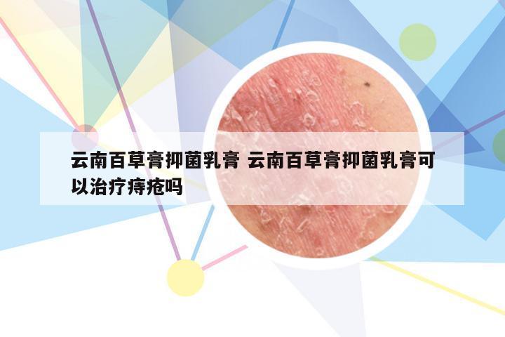 云南百草膏抑菌乳膏 云南百草膏抑菌乳膏可以治疗痔疮吗