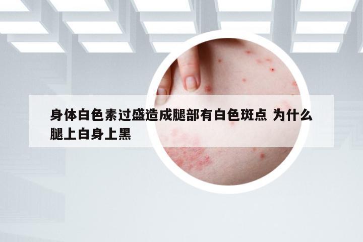 身体白色素过盛造成腿部有白色斑点 为什么腿上白身上黑