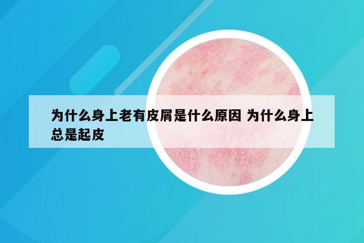 为什么身上老有皮屑是什么原因 为什么身上总是起皮