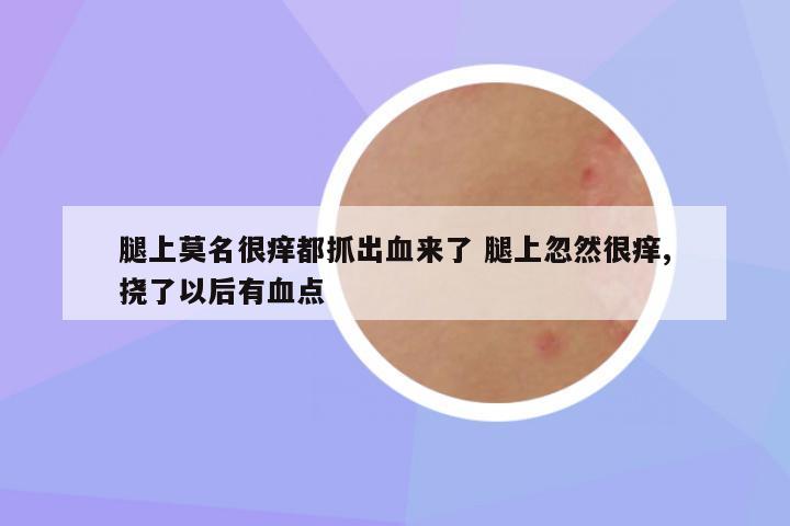 腿上莫名很痒都抓出血来了 腿上忽然很痒,挠了以后有血点