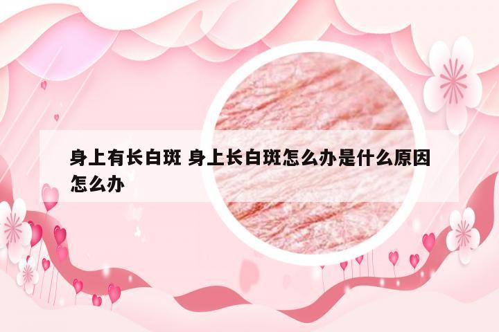 身上有长白斑 身上长白斑怎么办是什么原因怎么办