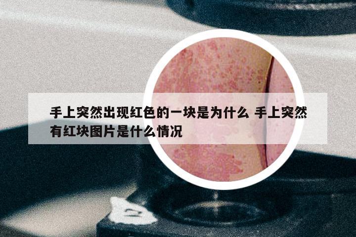 手上突然出现红色的一块是为什么 手上突然有红块图片是什么情况