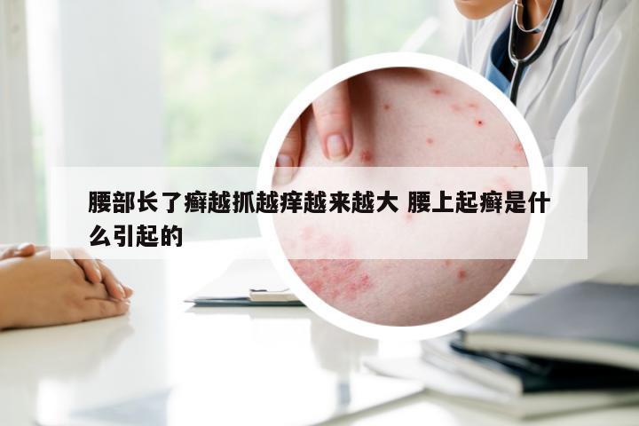 腰部长了癣越抓越痒越来越大 腰上起癣是什么引起的