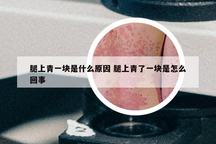 腿上青一块是什么原因 腿上青了一块是怎么回事