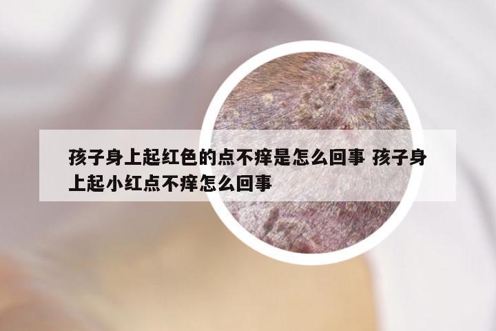 孩子身上起红色的点不痒是怎么回事 孩子身上起小红点不痒怎么回事