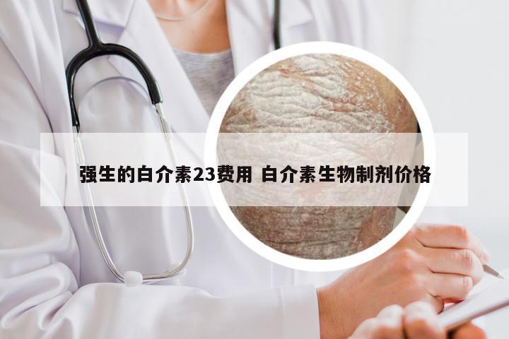 强生的白介素23费用 白介素生物制剂价格