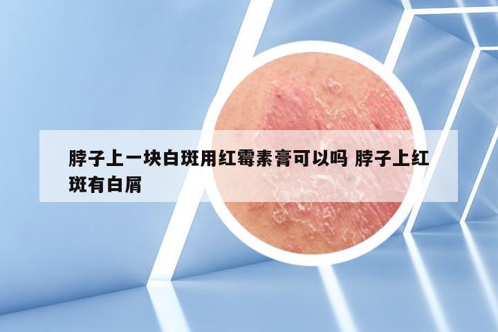 脖子上一块白斑用红霉素膏可以吗 脖子上红斑有白屑