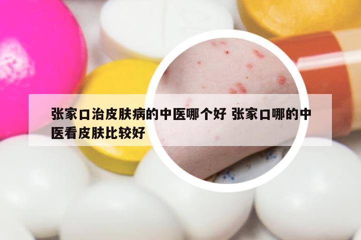 张家口治皮肤病的中医哪个好 张家口哪的中医看皮肤比较好