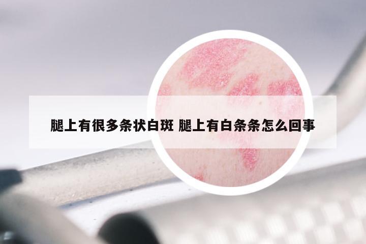 腿上有很多条状白斑 腿上有白条条怎么回事