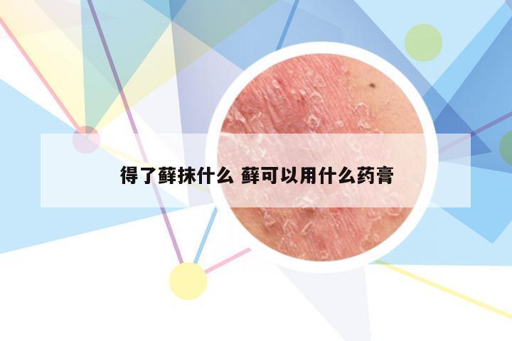 得了藓抹什么 藓可以用什么药膏