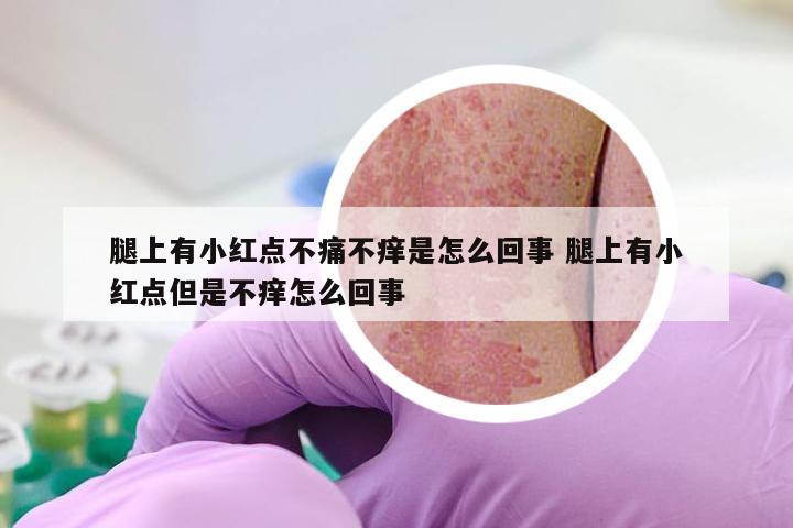 腿上有小红点不痛不痒是怎么回事 腿上有小红点但是不痒怎么回事