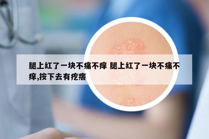 腿上红了一块不痛不痒 腿上红了一块不痛不痒,按下去有疙瘩