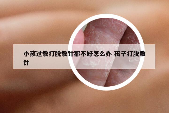 小孩过敏打脱敏针都不好怎么办 孩子打脱敏针