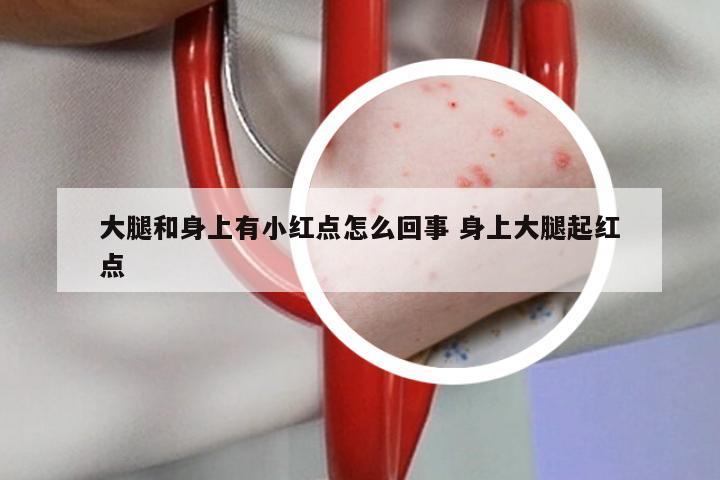 大腿和身上有小红点怎么回事 身上大腿起红点