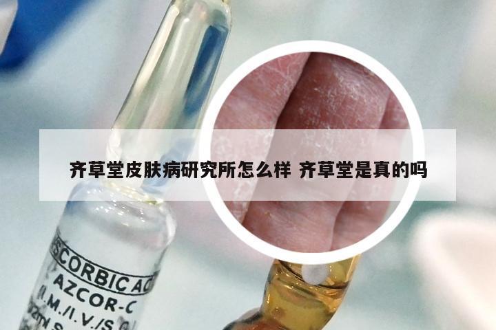 齐草堂皮肤病研究所怎么样 齐草堂是真的吗