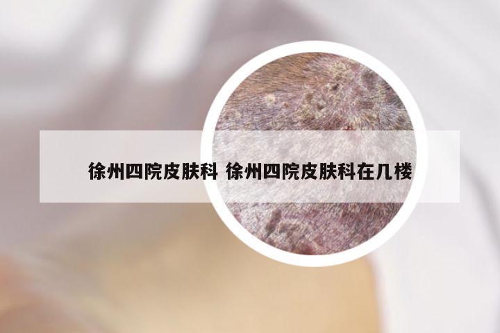 徐州四院皮肤科 徐州四院皮肤科在几楼