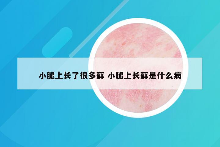 小腿上长了很多藓 小腿上长藓是什么病