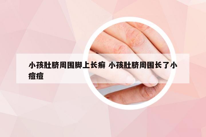 小孩肚脐周围脚上长癣 小孩肚脐周围长了小痘痘