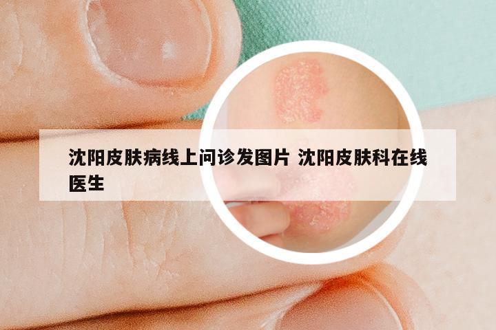 沈阳皮肤病线上问诊发图片 沈阳皮肤科在线医生