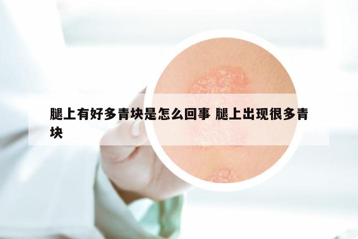 腿上有好多青块是怎么回事 腿上出现很多青块