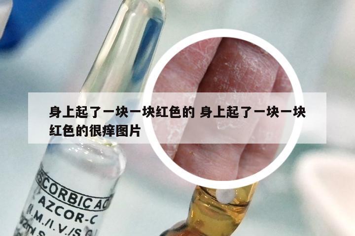 身上起了一块一块红色的 身上起了一块一块红色的很痒图片