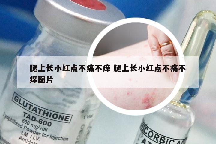 腿上长小红点不痛不痒 腿上长小红点不痛不痒图片