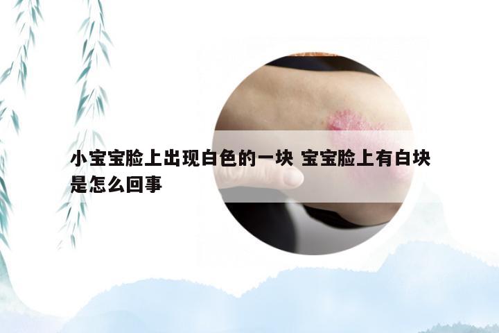 小宝宝脸上出现白色的一块 宝宝脸上有白块是怎么回事