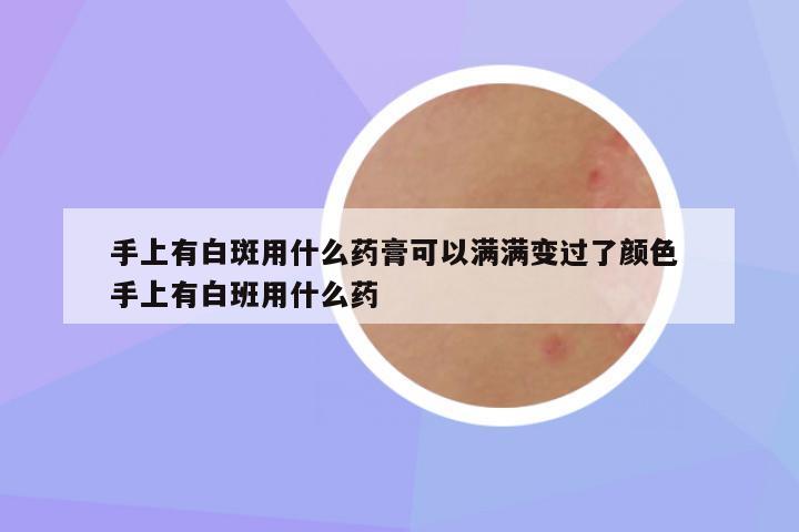 手上有白斑用什么药膏可以满满变过了颜色 手上有白班用什么药