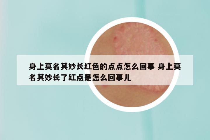 身上莫名其妙长红色的点点怎么回事 身上莫名其妙长了红点是怎么回事儿